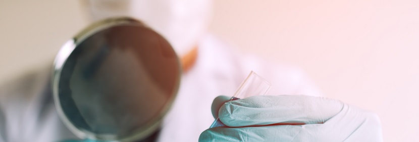 牙科修復體用聚合物基粘接劑檢測